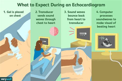 how is echocardiogram test done