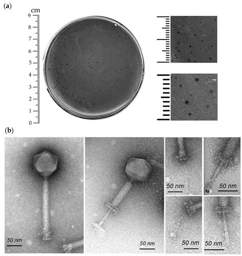 how is enterococcus contracted