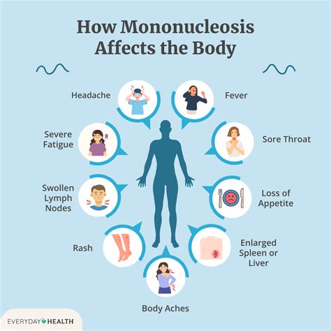 how is mono diagnosed and treated