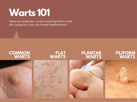 how long do hpv warts stay