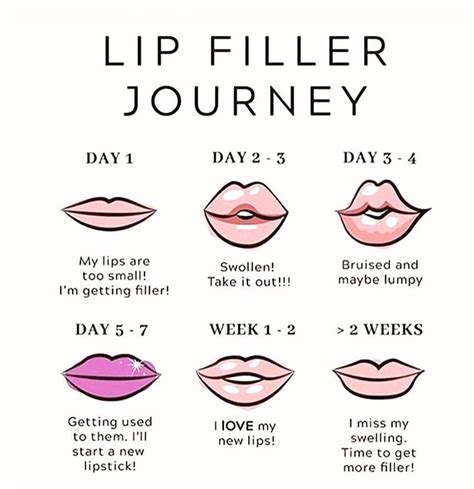 how long do swollen lips from kissing last