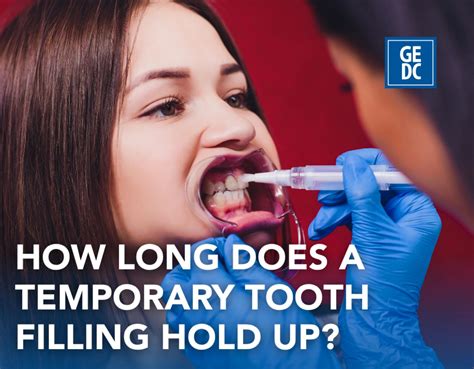 How Long Does A Temporary Crown Last