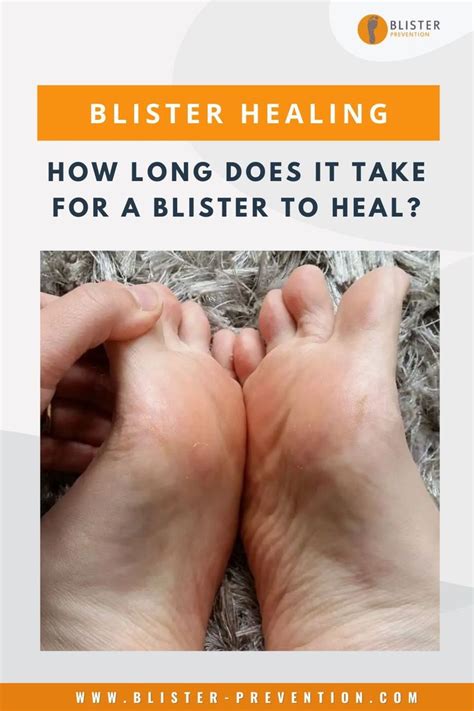 how long does it take for cantharidin blisters to heal