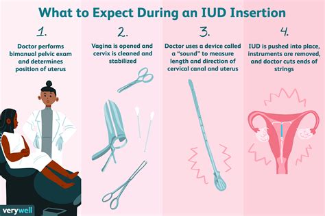 how long is an iud procedure