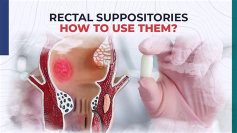 how long should a suppository take