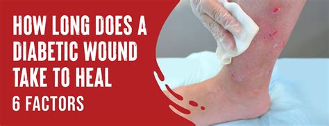 how long should wounds take to heal
