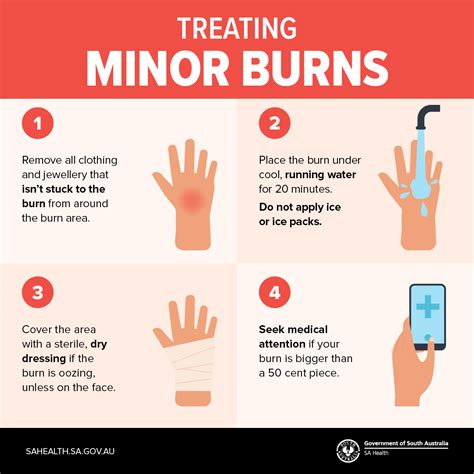 how long to cool a minor burn