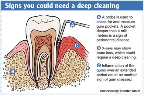 how much is a routine teeth cleaning
