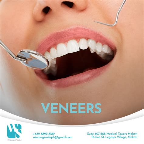 how much is composite veneers in the philippines