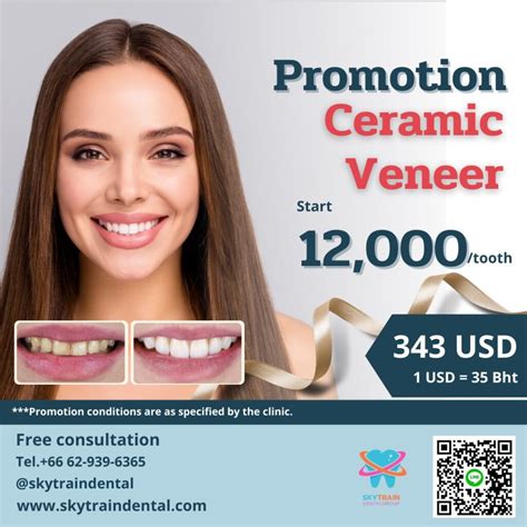 how much to get veneers