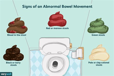 how often is a normal bowel movement