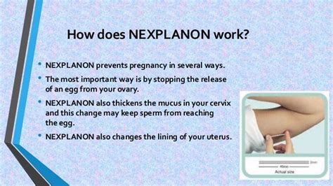 how soon does nexplanon work after insertion