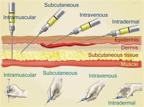 how to administer a subcutaneous injection