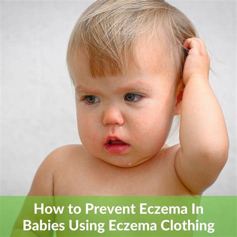 how to avoid eczema in babies