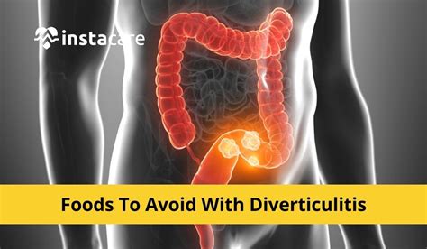 how to avoid getting diverticulitis