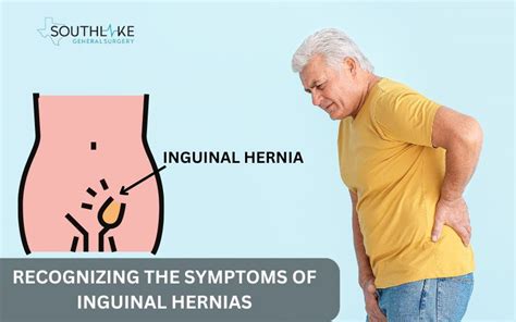 how to check for groin hernia