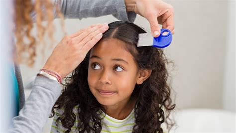 how to check for lice and nits