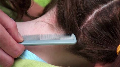 how to check for lice on child