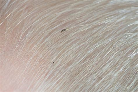 how to check for lice on child