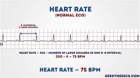 how to check heart rate in ecg