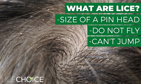 how to curtail for lice instruction nits