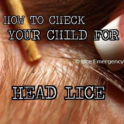 how to check your kid for lice