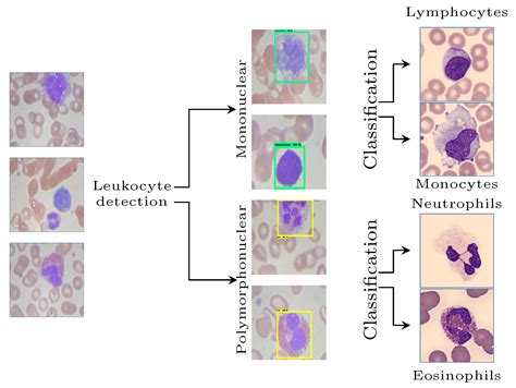 how to classify the leukocytes(WBC) using CNN - MATLAB …