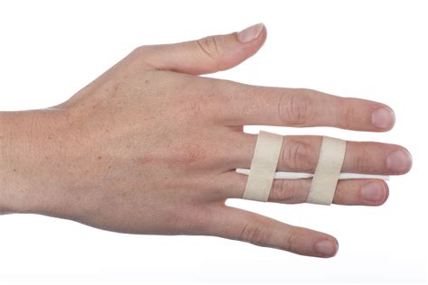 how to heal contused finger