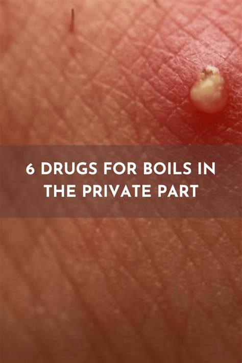 how to cure boil in private part
