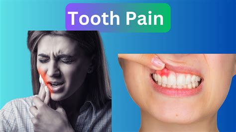 how to cure from tooth pain