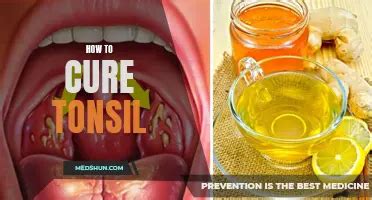 how to cure tonsils and cough