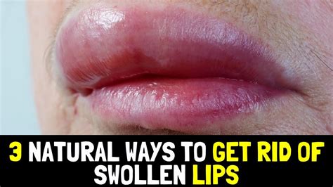how to decrease swelling in lips