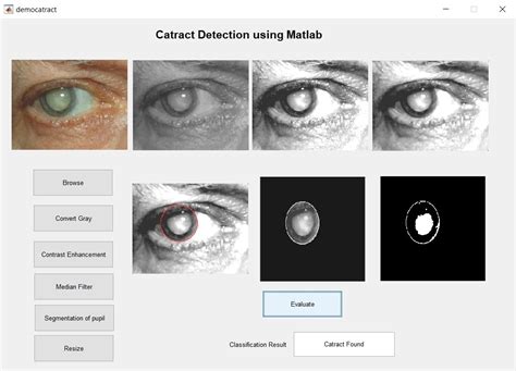 how to detect eye blink in matlab through webcam