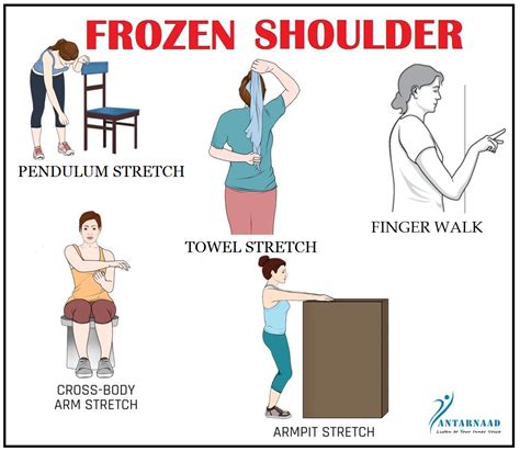 how to exercise frozen shoulder