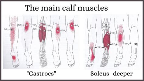 how to find trigger points in calves