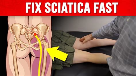 how to fix sciatica fast