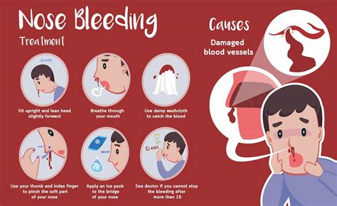 how to get a nose bleed