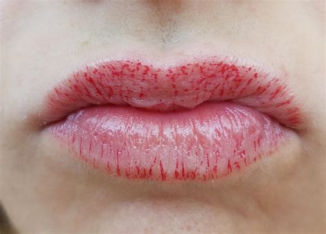 how to get off lip stains
