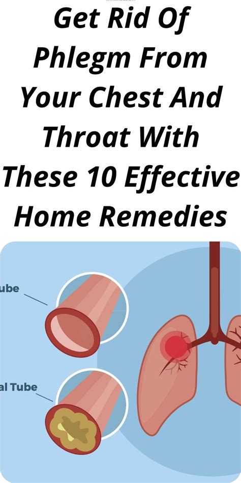 how to get rid cough with phlegm