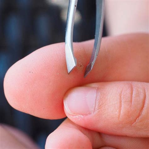 how to get rid of a sliver