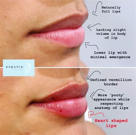how to have a small lip
