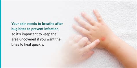 how to heal a bug bite