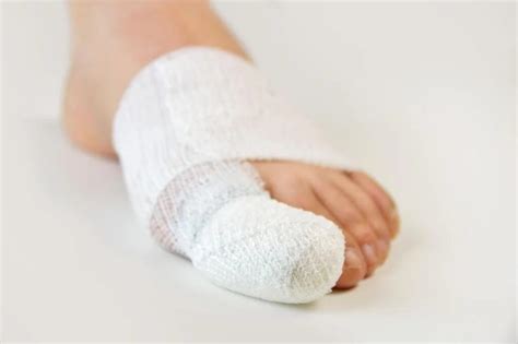 how to heal a smashed toe
