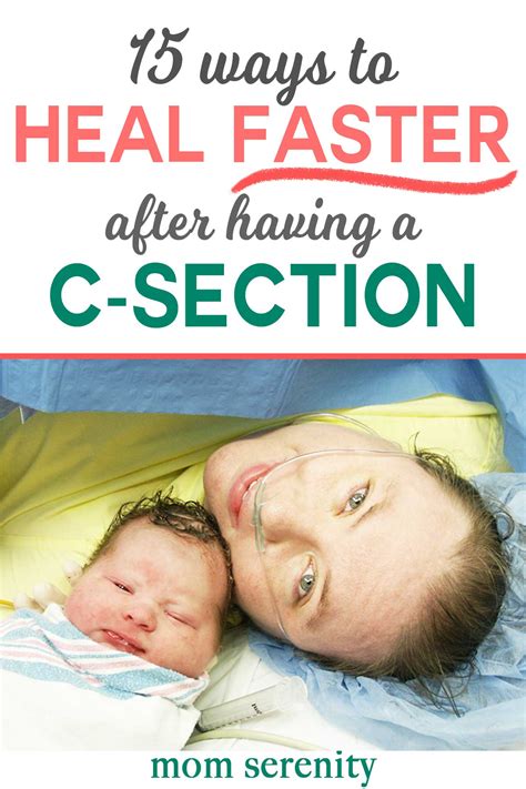 how to heal faster after ac section