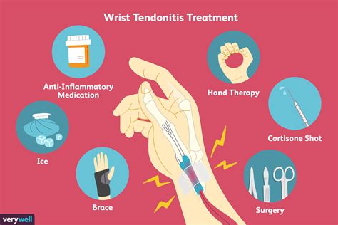 how to heal tendonitis in hand