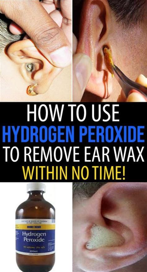 how to hydrogen peroxide in ear