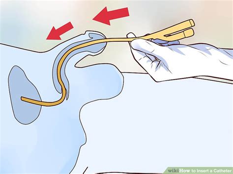 how to insert a straight catheter