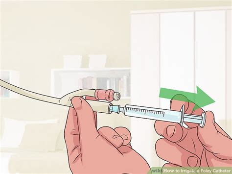 How To Irrigate A Foley Catheter