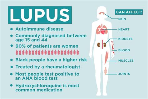 how to know if you have lupus