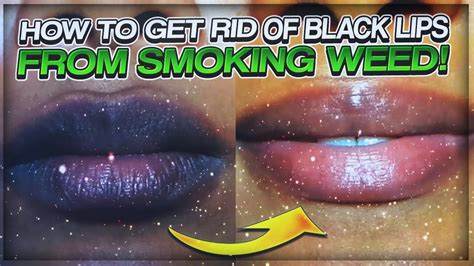 how to lighten dark lips from smoking weed